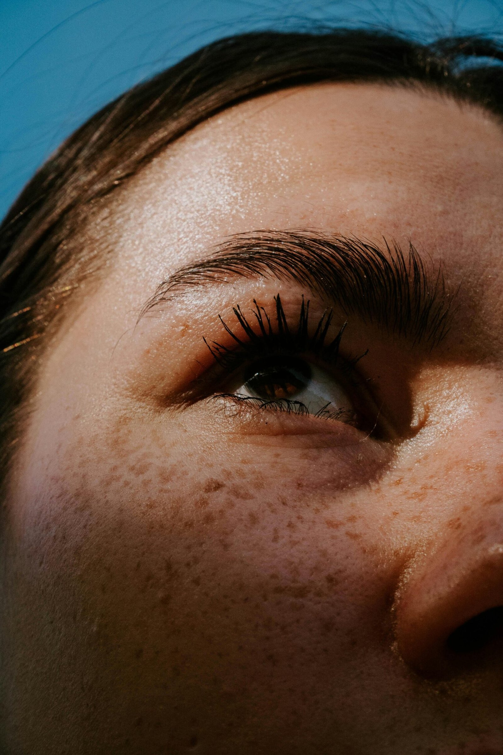 Dark spots on skin