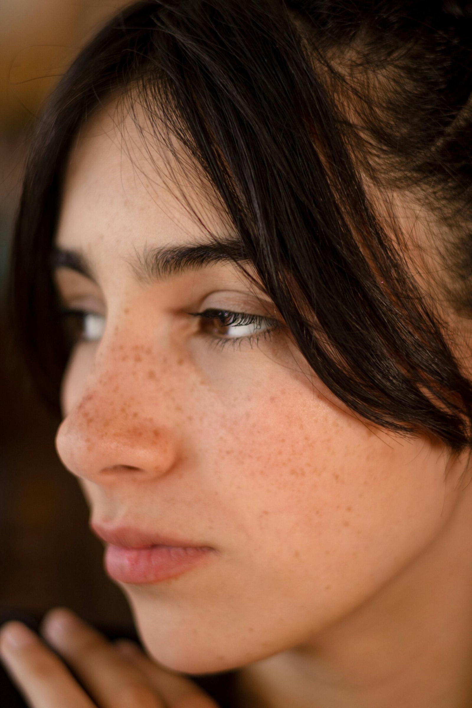 Solar lentigines sun spots on skin