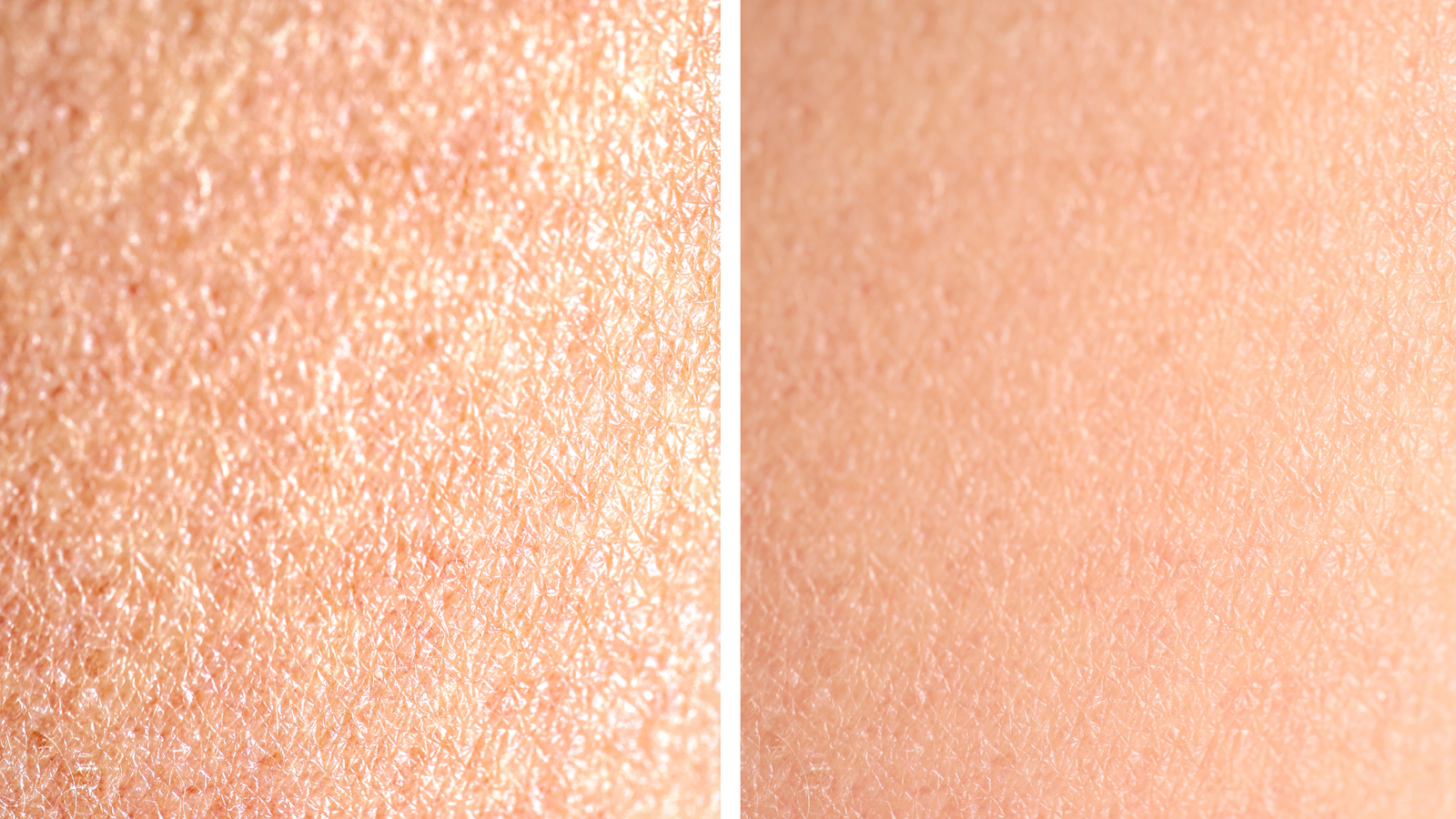 Uneven Skin Tone vs Rough Skin Texture: How to Treat Both