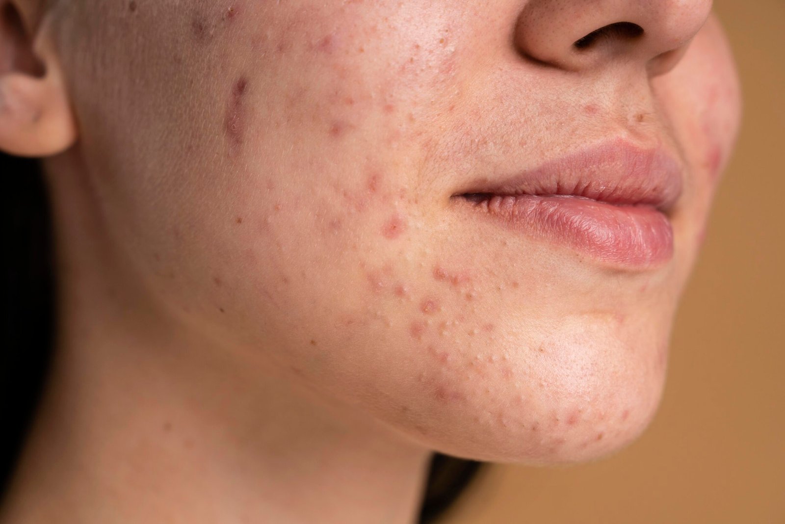 Settled pigmentation