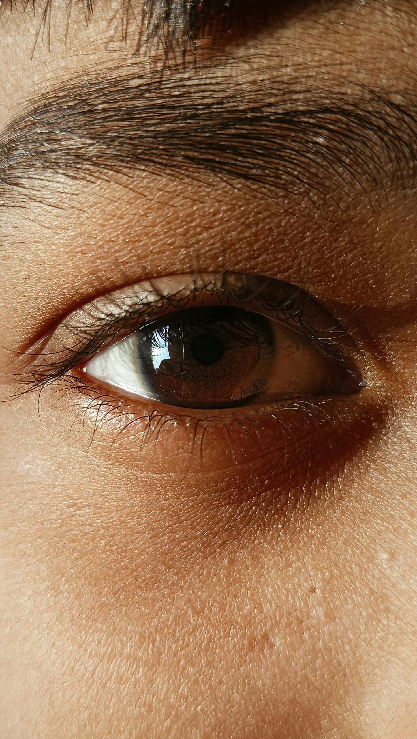 Under-eye periorbital skin close-up