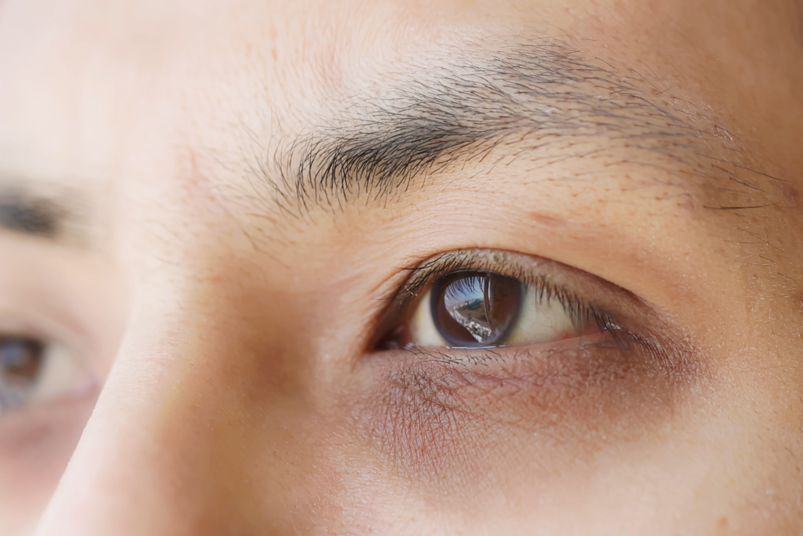 Why Dark Circles Get Worse With Age