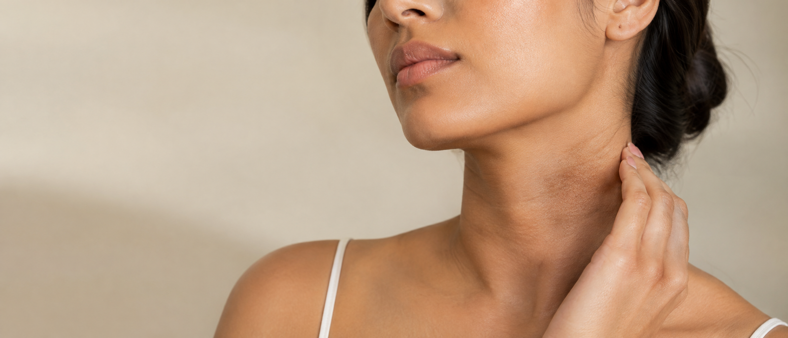 Hyperpigmentation on neck: how to fade dark patches below the jaw, Kinoko Labs